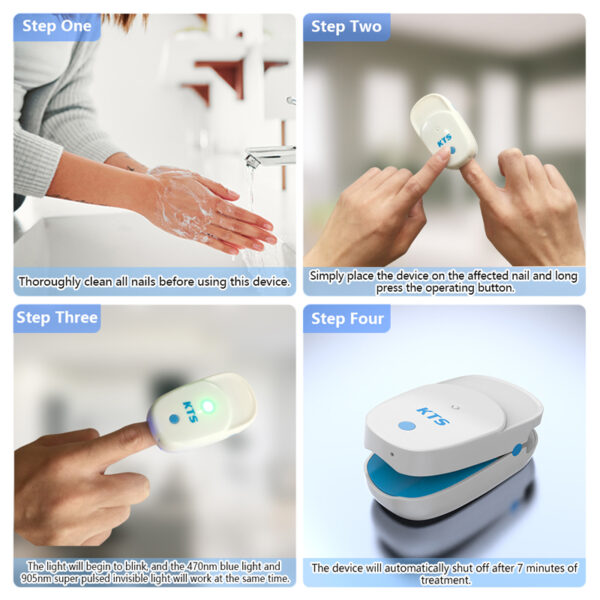 KTS Nail Fungus Laser Therapy Device 905nm 470nm Fungal Nail Treatment for Fingernails Toenails Onychomycosis Cure 5